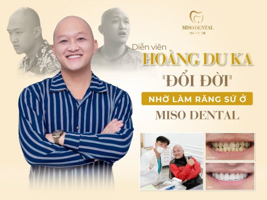 Diễn viên Hoàng Du Ka "đổi đời" nhờ làm răng tại Miso Dental