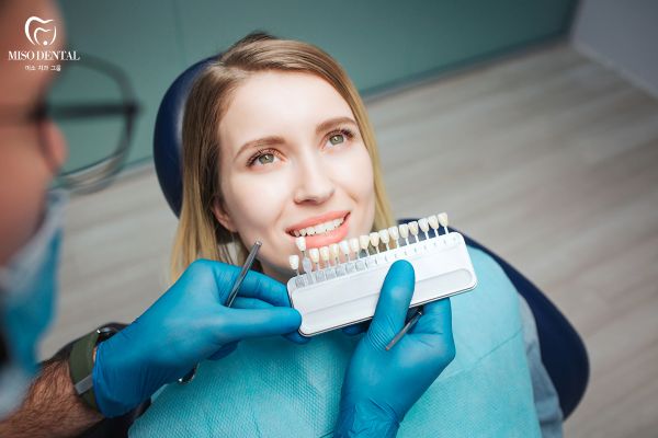 Giá dán răng sứ veneer